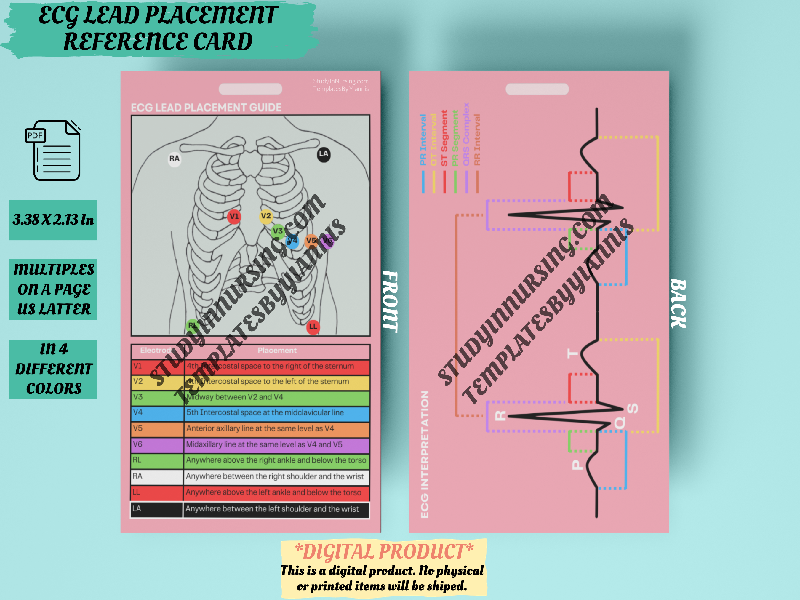 ECG Lead Placement Reference Card